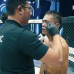BACKSTAGE MOMENT OP87: Cueng Naibaho harus dijahit pasca menang di OP87